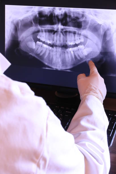 Best Emergency Treatment for Oral Infections in Paddock Lake, WI