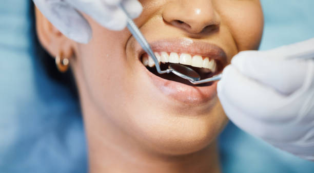 Best Knocked-Out Tooth (Avulsed Tooth) Treatment in Paddock Lake, WI