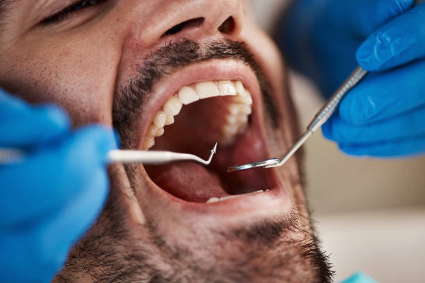 Best Emergency Dental Care for Sports Injuries in Paddock Lake, WI