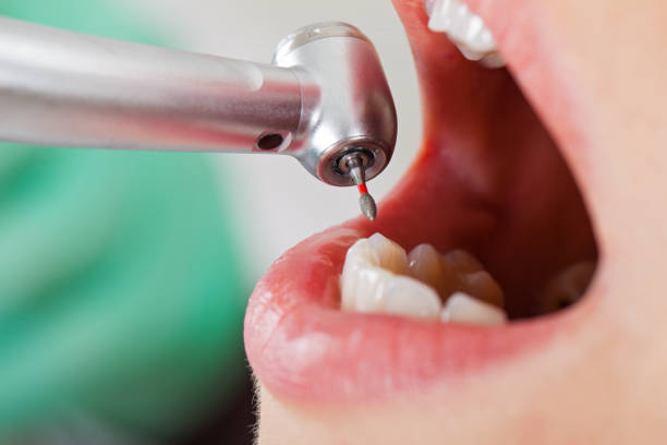 Best Emergency Root Canal Therapy in Paddock Lake, WI
